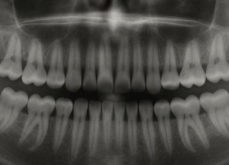 داهێنانەکا یابانی یا مێژوویی دوارێ چارەسەریا ددانان دا