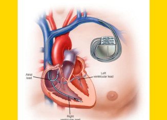 کی پێدڤی ب کارئینانا پاتریێن دلی دبیت؟