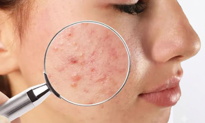 نیشانێن کێمبوونا ئۆمێگا 3 چنە؟